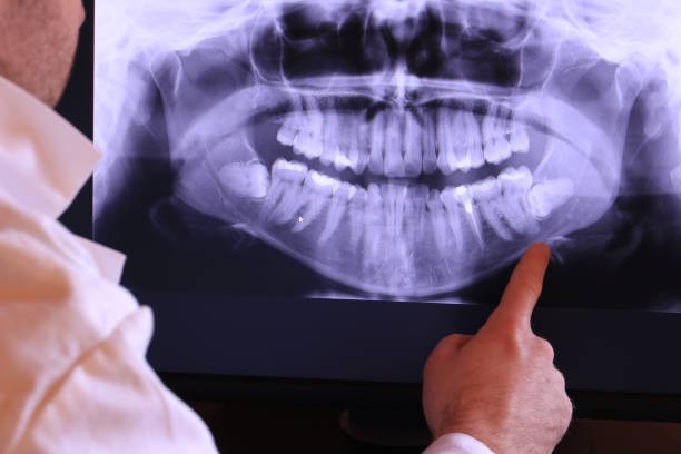 Best Emergency Tooth Extraction in Essex, MD
